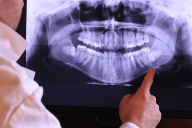 Best Emergency Tooth Extraction in Denmark, WI