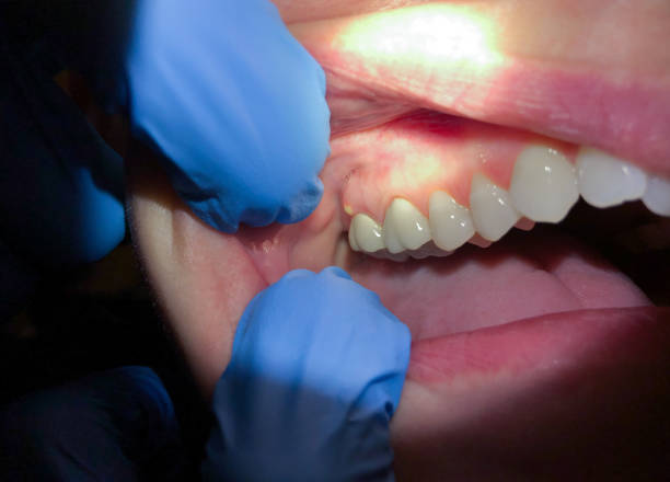 Best Emergency Dental Care for Broken or Chipped Teeth in Denmark, WI
