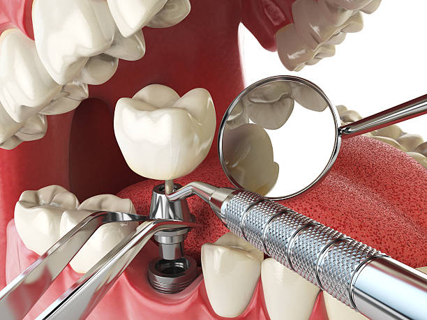Best Emergency Dental Care for Broken or Chipped Teeth in Denmark, WI